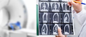 Un fármaco experimental combate un cáncer que va en aumento y ya es el quinto más mortal