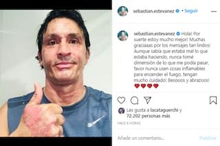 Sebastián Estevanez mostró cómo le quedó el rostro tras el accidente doméstico