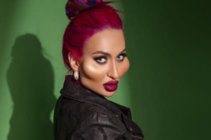 Tras seis años de operaciones, Anastasia Pokreshchuk se convirtió en la mujer con los pómulos más grandes del mundo