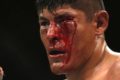 Aldana, guerrero como todo mexicano, aguantó el castigo y convivió con un corte profundo en el párpado del ojo izquierdo.