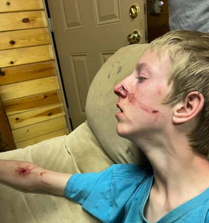 Un adolescente fue atacado por un oso en Arizona