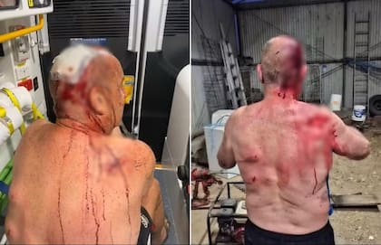 Un adulto mayor fue atacado brutalmente por un canguro cuando intentó defender a su perro; el marsupial le dejó heridas graves