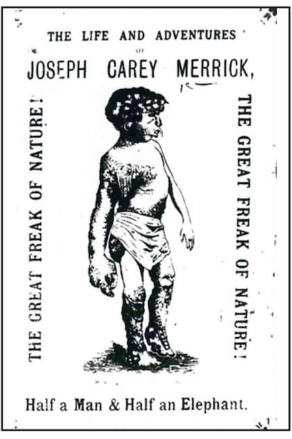 Un afiche que promocionaba una presentación de Joseph Merrick, "mitad hombre y midad elefante", en sus primeros años como fenómeno