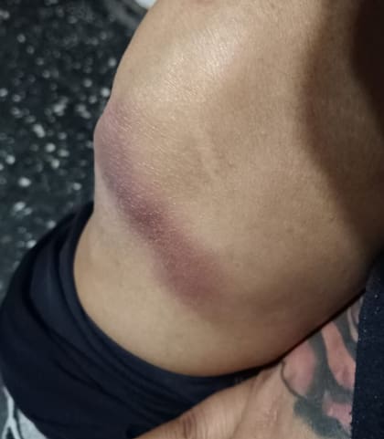 Un cascote cayó del techo de la sala del cine y golpeó la rodilla de Fiamma