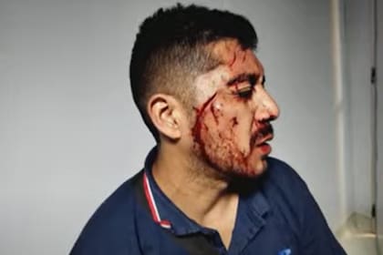Un chofer de la línea 218 fue agredido, motivo por el que los colectivos de la empresa Almafuerte hacen un paro este viernes 21 de marzo