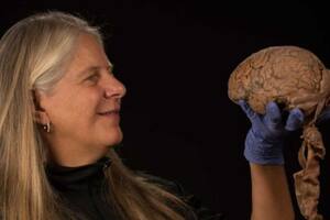 Un derrame cerebral cambió para siempre la vida de la neurocientífica estadounidense Jill Bolte Taylor