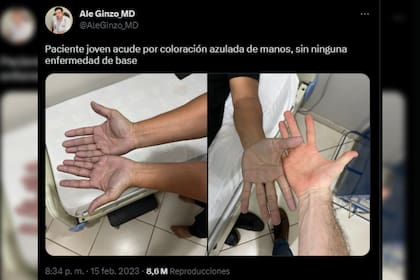 Un doctor presentó un caso que llamó la atención en las redes sociales (Captura Twitter @AleGinzo_MD)