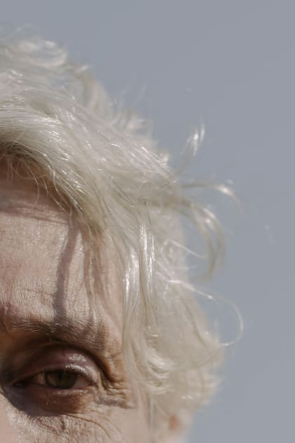 Un estudio de la Mayo Clinic reveló que más del 55% de los casos de encanecimiento precoz se relaciona con una deficiencia nutricional