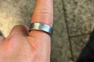 Se compró un anillo inteligente, la batería se empezó a hinchar y terminó en el hospital
