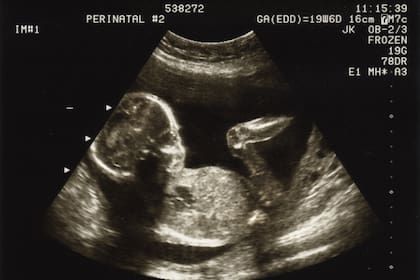 Un feto en la semana 20