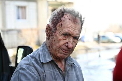 Un herido en el este ucraniano tras los ataques rusos. (Photo by Aris Messinis / AFP)
