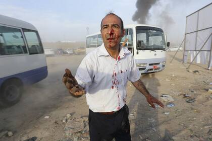 Un hombre ensangrentado sobrevive al doble atentado que ocurrió en Irak a cinco días de las elecciones