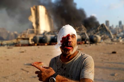 Un hombre herido señala el sitio de la explosión