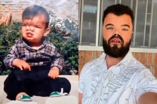 Nació con una condición poco común, pero una cirugía cambió su vida y hoy es un exitoso violinista