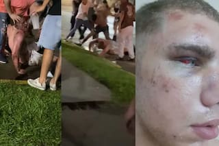 Un joven de 17 años sufrió una feroz golpiza a la salida de un boliche y quedó inconsciente