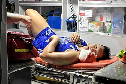 El basquetbolista agredido fue diagnosticado con una conmoción cerebral, fractura de hombro, labio roto, mandíbula ensangrentada y pérdida parcial de un diente