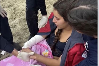 Un león marino le mordió el brazo derecho a Phoebe Beltrán mientras nadaba en Long Beach