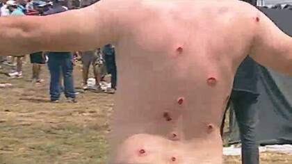 Un manifestante fue alcanzado por balas de goma