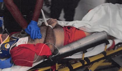 Un médico realiza maniobras de reanimación cardiopulmonar (RCP) a Jeffrey Epstein