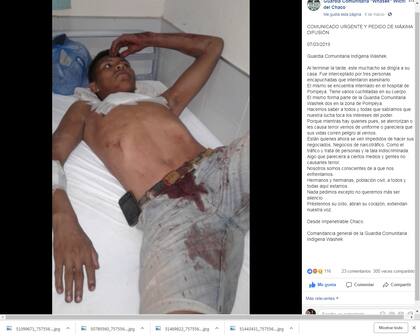 Un miembro de las Guardias comunitarias de los wichis en El Impenetrable, atacado por encapuchados