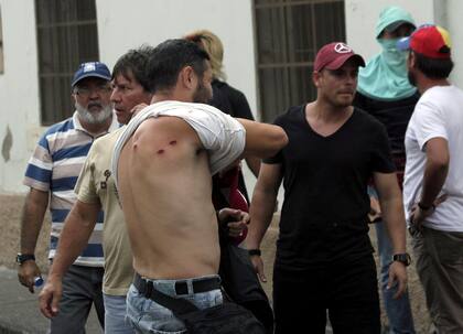Un opositor al gobierno de Maduro exhibe heridas de postas de goma