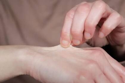 Un órgano que se regenera constantemente a una escala enorme es la piel