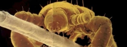 Un piojo adherido a un pelo, bajo el lente del microscopio