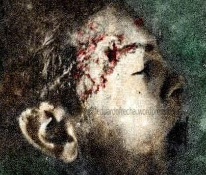 "Un proyectil impactó en mi casco y lo perforó. Me agarró de refilón el craneo y me sacó parte de la oreja. Sentí el golpe y un estruendo como si estuviera dentro de una campana y caí desmayado dentro del pozo. Estoy convencido de que la Virgen me protegió, creo que la mano de Ella estaba arriba del casco”, detalla tras recordar el momento