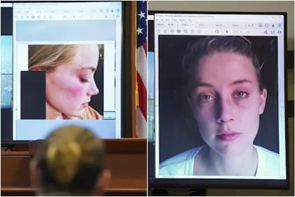 Una amiga de Amber Heard testificó haber visto moretones y cortadas en el rostro de la actriz (Foto: AFP)
