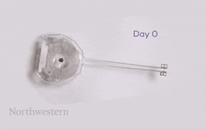 Una animación muestra el proceso de descomposición del marcapasos temporal