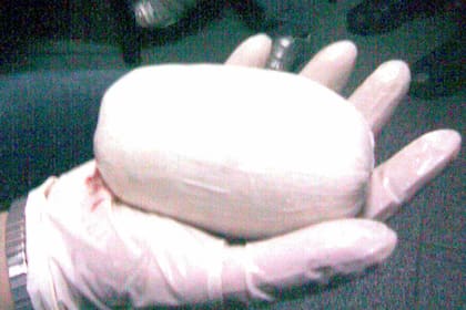 Una cápsula de 400 gramos de cocaína fue extraída de la vagina de una mujer
