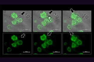 Descubren cómo algunos tumores logran dormir a las defensas del cuerpo