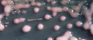Las dos bacterias halladas en el fentanilo suministrado a nueve pacientes fallecidos