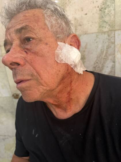 Una de las heridas que sufrió el padre tras ser agredido dentro del taller de San Justo