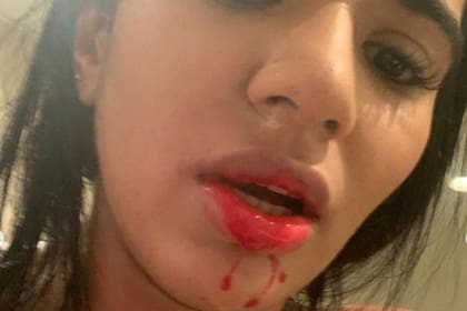 Una de las imágenes que Daniela Cortés Meneses publicó en su cuenta de Instagram para denunciar en forma pública la agresión de Sebastián Villa