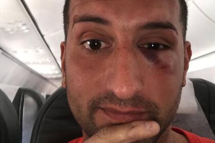 Una de las personas heridas, al abordar el avión