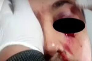 Tras la pelea en la puerta del colegio, habló la mujer del hombre que podría perder el ojo: “Lo patearon en el piso”