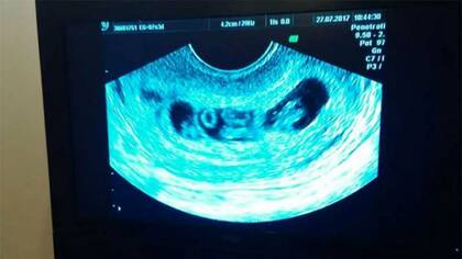 Una ecografía de Yanina Gutiérrez