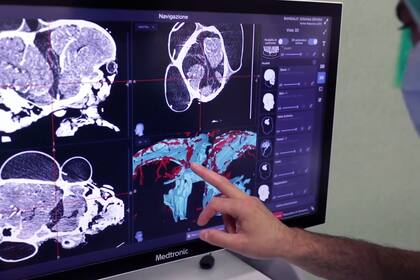 Una foto de junio de 2020 muestra a un médico revisando una representación en 3D de los cráneos de las hermanas gemelas Ervina y Prefina