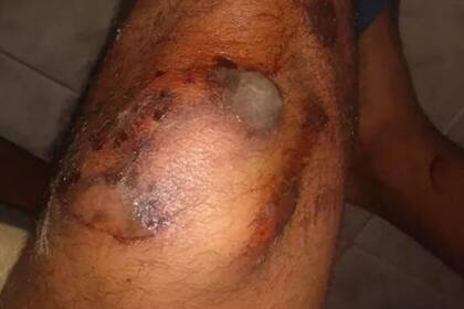 Una imagen compartida por el joven herido