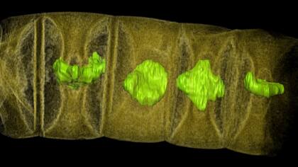 Una imagen de tomógrafo de un fósil de algas rojas, teñidas para mostrar detalles.