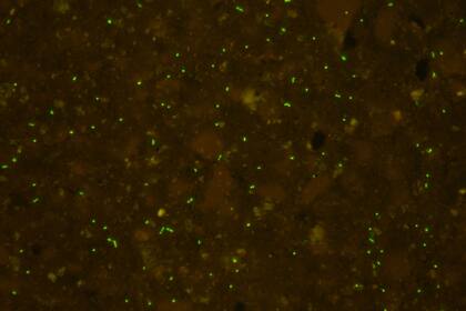 Una imagen obtenida de una de las muestras por medio de microscopía de fluorescencia