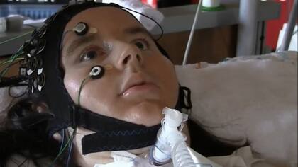 Una interfaz cerebro-máquina permite que afectados por el ''síndrome de cautiverio'' puedan responder preguntas