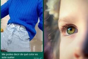 Una joven contó cómo es su día a día con daltonismo y generó un debate en las redes sociales