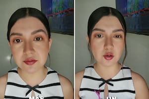 Una joven decidió donar un riñón a su novio que padecía insuficiencia renal y no se imaginó lo que iba a suceder (Foto: Captura Tiktok @soyadiilu)