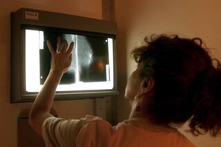 Revelan que la metástasis del cáncer avanza de noche