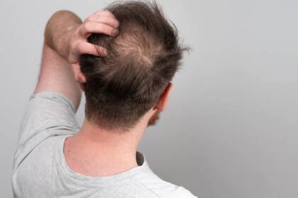 Una mascarilla puede ayudar a frenar de la caída del cabello (Foto Pexels)