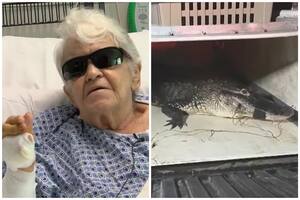 Una mujer de 84 años luchó contra un caimán para salvar a su mascota