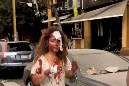 Una mujer herida camina por las calles de Beirut luego de la gran explosión que afectó a esa ciudad