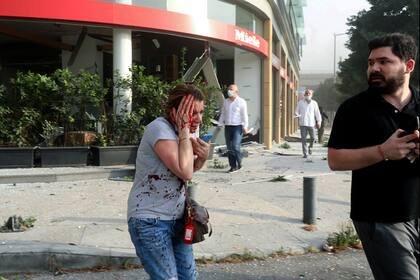 Una mujer herida por la explosión en Beirut